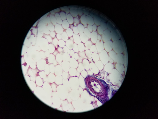 Adipose Connective Slides - Adipose Connective 04 400X